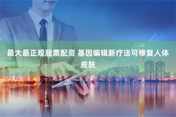 最大最正规股票配资 基因编辑新疗法可修复人体皮肤